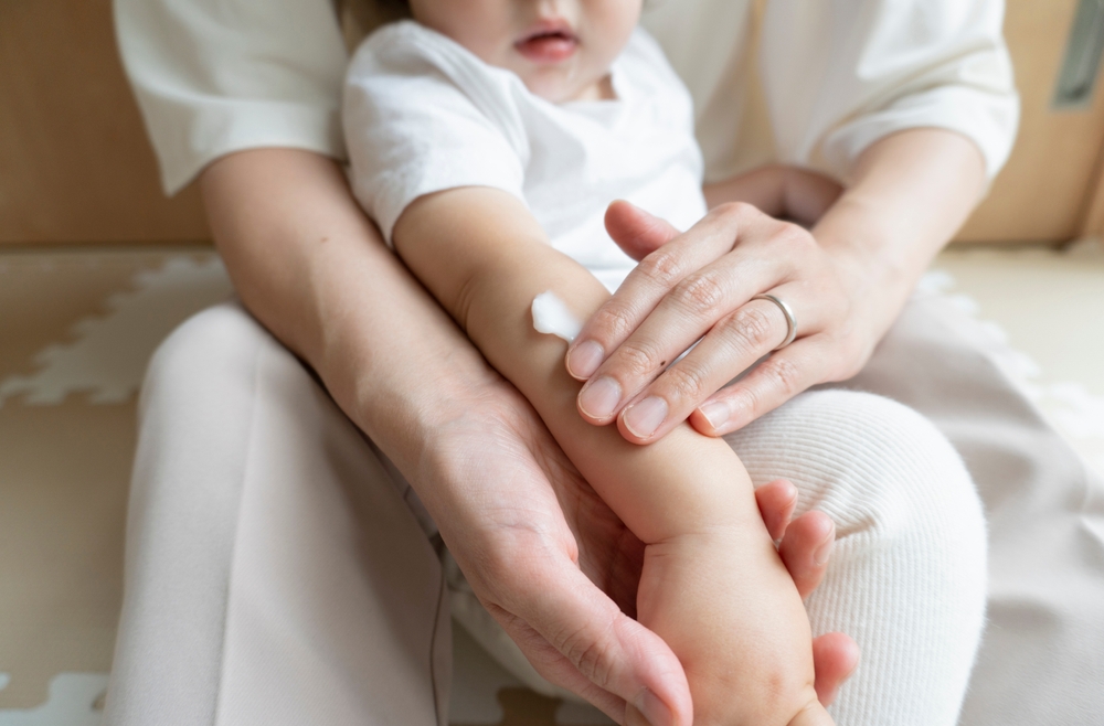 子どもの乾燥肌に使える市販薬（保湿剤）を紹介｜クリームタイプ、ローションタイプなど