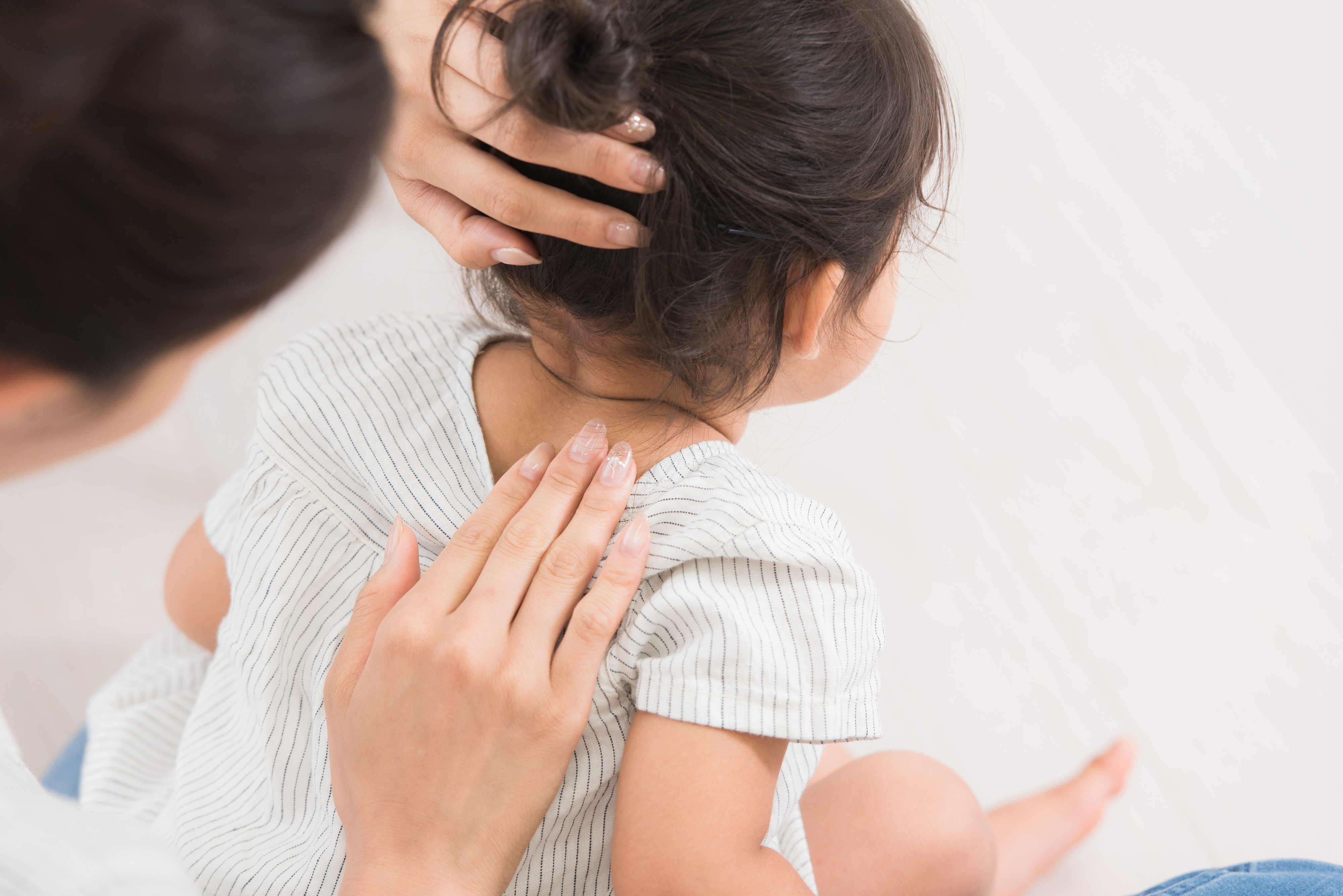 汗かぶれ（汗あれ）に効く市販薬｜ステロイド配合・無配合の塗り薬を紹介