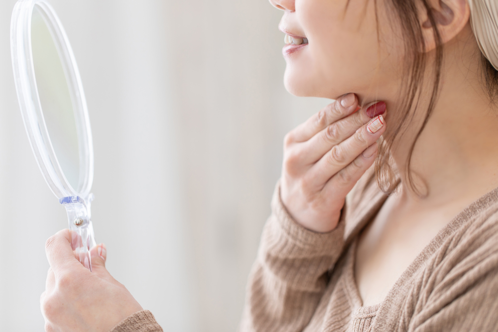 あごニキビに効く市販薬|原因やおすすめの予防法も紹介