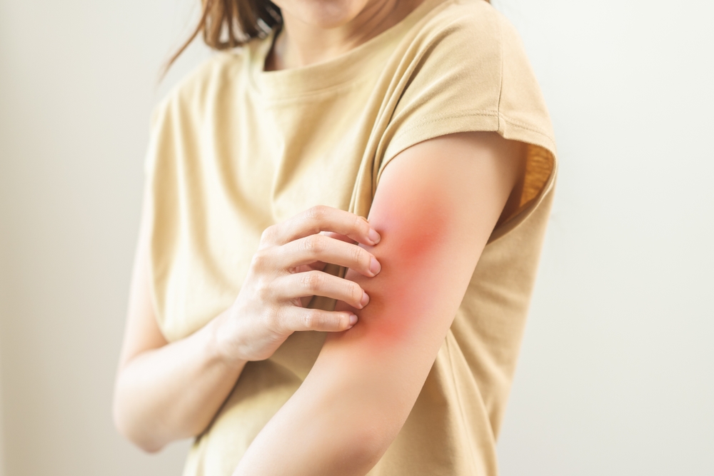 湿布が光線過敏症の原因に？日光アレルギーの対処法や病院に行くべき目安とは